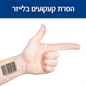 הסרת קעקועים בלייזר